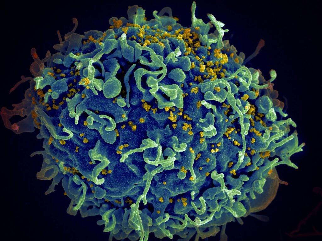 HIV Vaccine